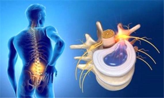 دیسک کمر را چگونه میتوان درمان کرد؟
