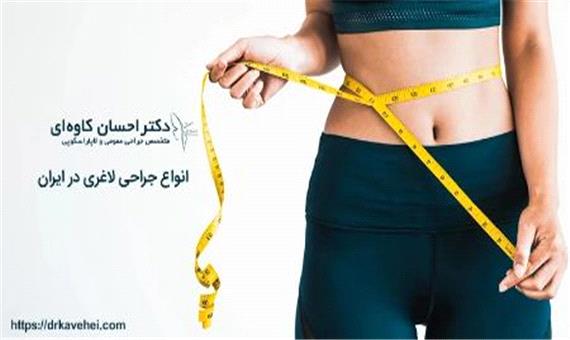 با انواع جراحی لاغری در ایران آشنا شوید