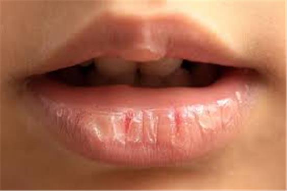 راز لب‌های نرم با اسکراب قهوه و شکر طبیعی