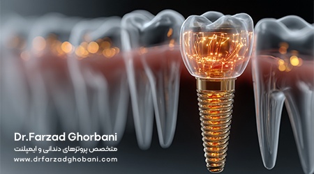 پیام آذری