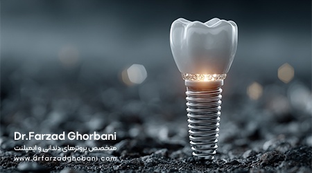 پیام آذری