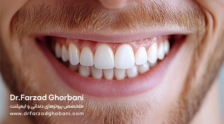 پیام آذری