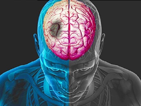پیام آذری