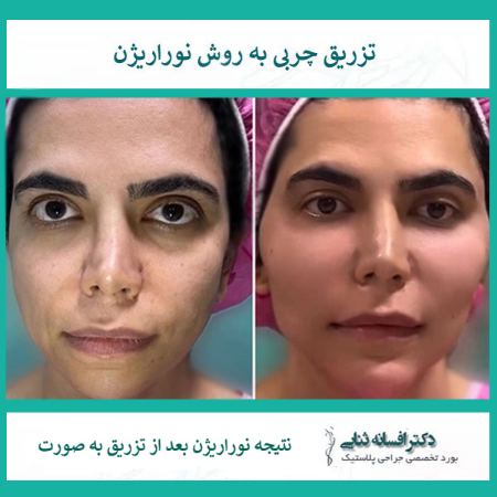 پیام آذری