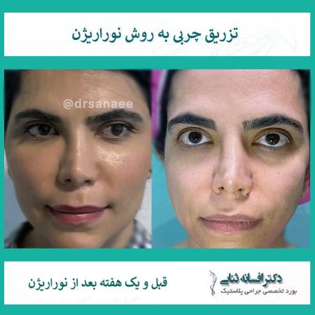 پیام آذری