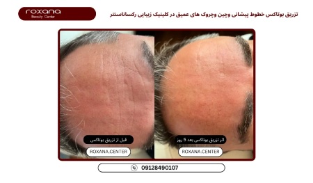 پیام آذری