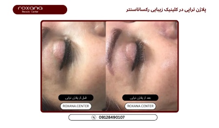 پیام آذری