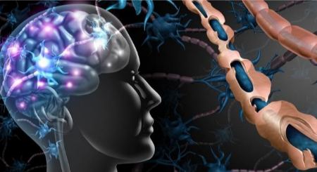 تست ام اس | روش های تشخیص ام اس، علائم + واقعیت تست ام اس در خانه