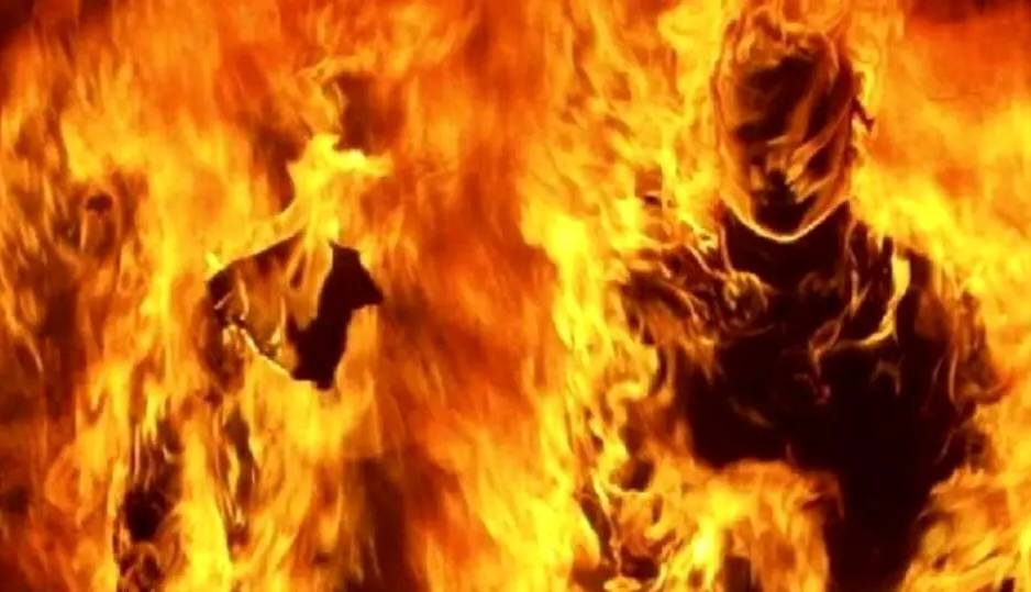 وضعیت وخیم احمد؛ جوان ۲۰ ساله‌ای که خودسوزی کرد در ICU بیمارستان اهواز