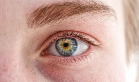 علت سیاهی دور چشم چیست و چطور از ایجاد آن جلوگیری کنیم؟